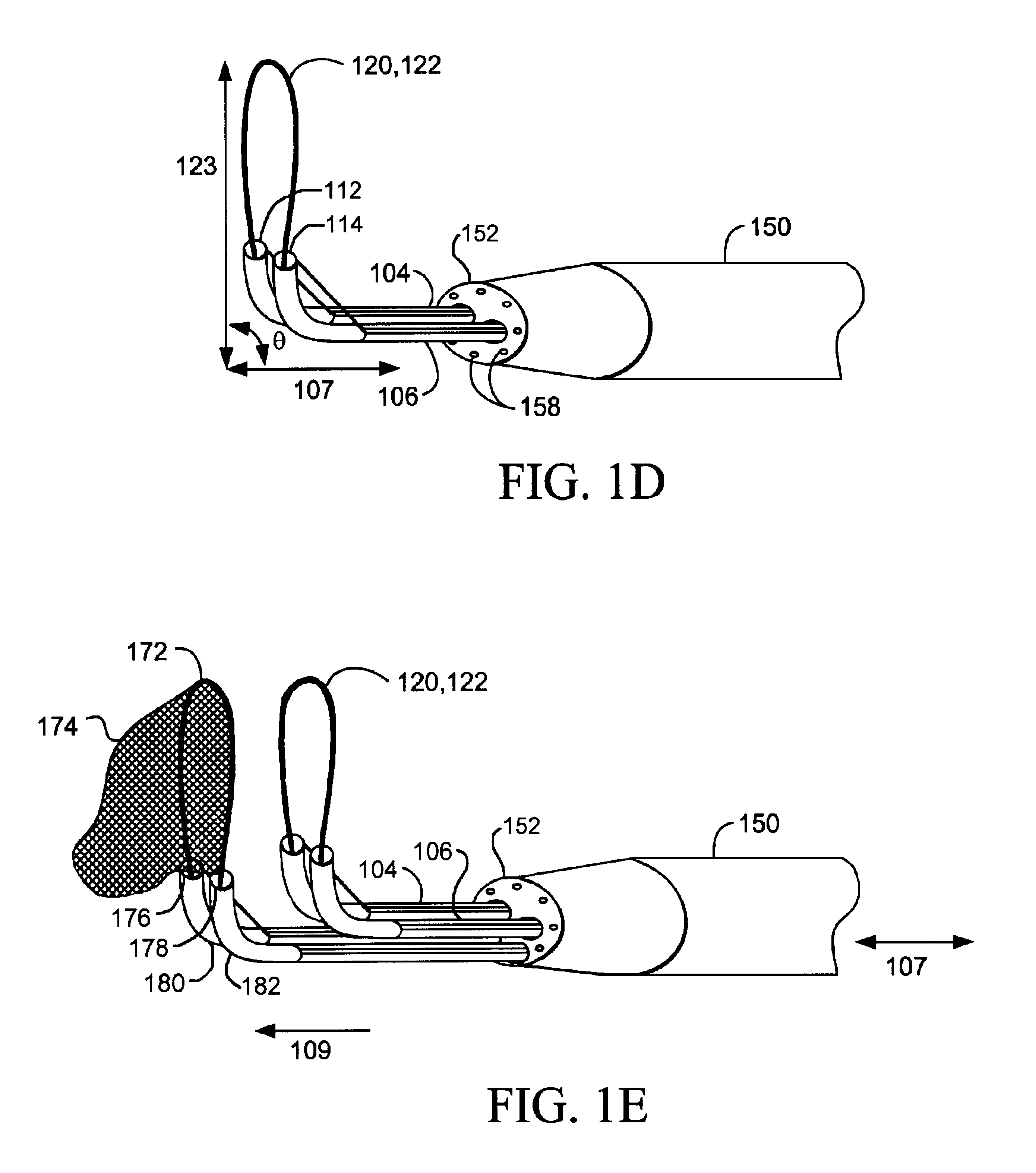 Devices and methods for tissue severing and removal