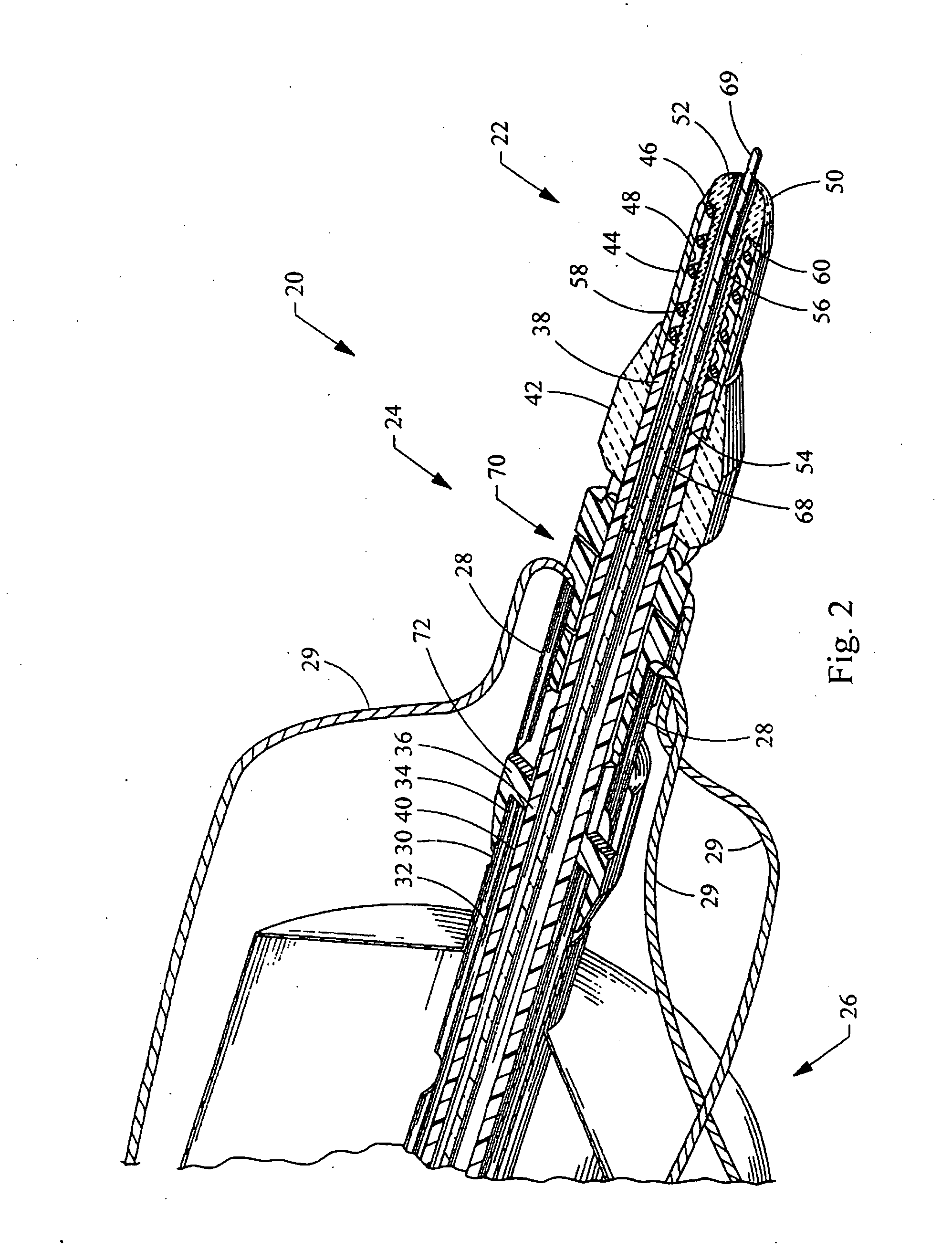 Device to open and close a bodily wall