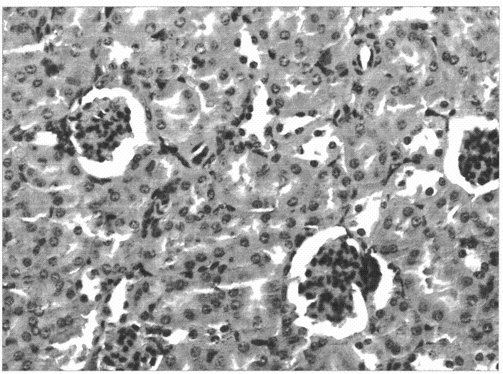 Medicinal food formula and medicinal edible preparation for preventing and treating hyperuricemia and gout