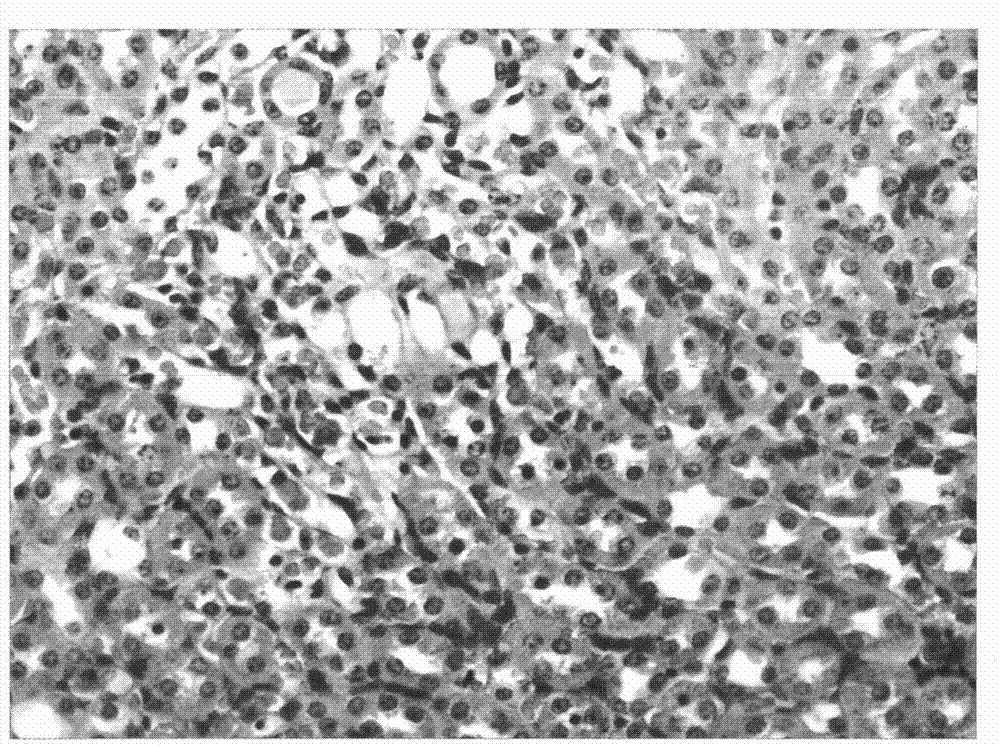 Medicinal food formula and medicinal edible preparation for preventing and treating hyperuricemia and gout