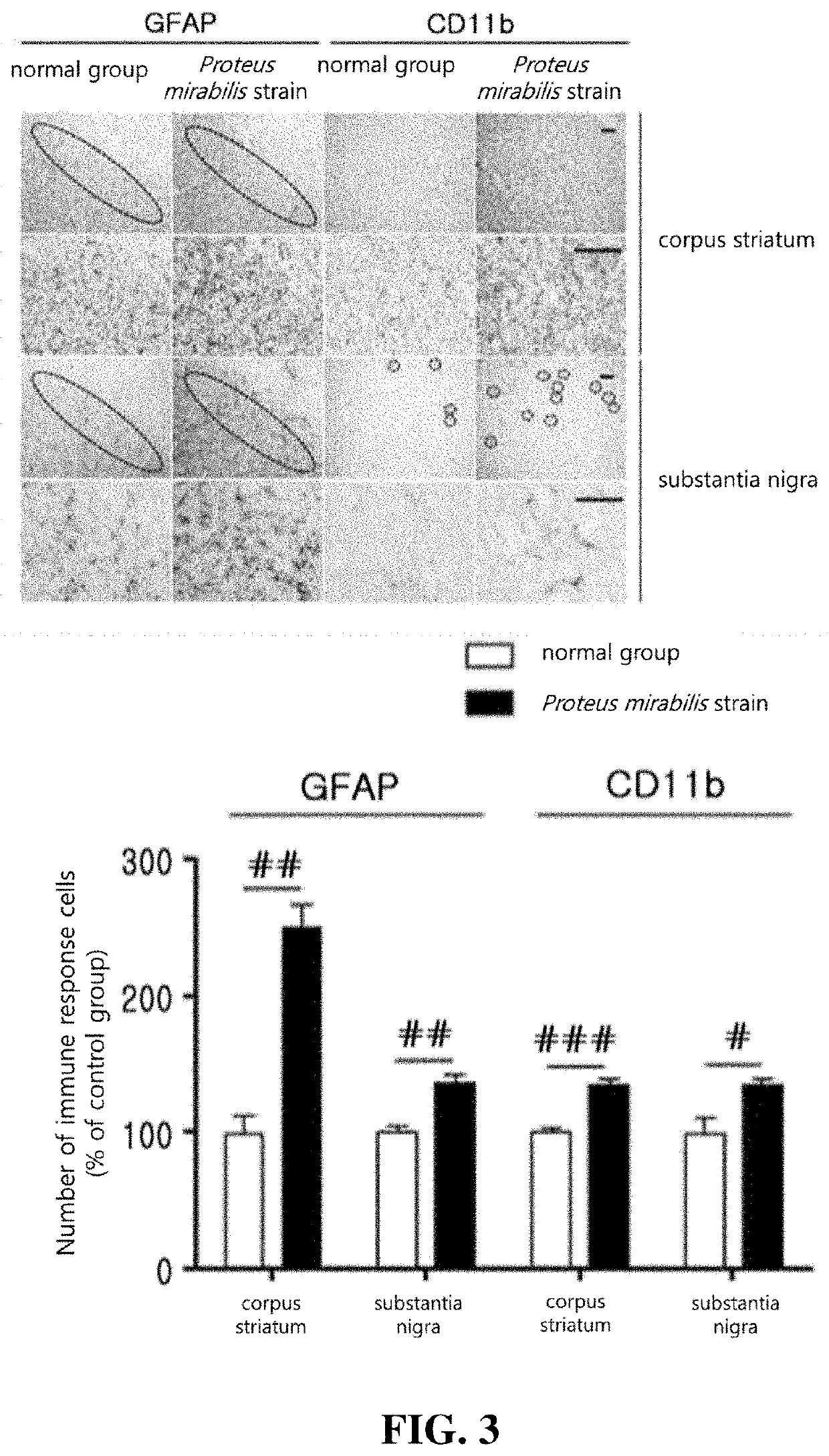 Information providing method for diagnosing parkinsons disease