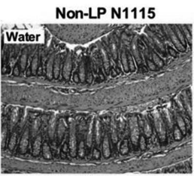 Application of lactobacillus paracasei N1115 in preventing colonitis, corresponding probiotic powder and application