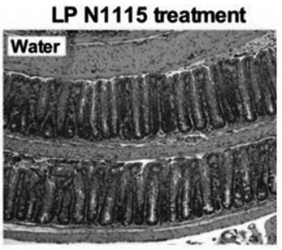 Application of lactobacillus paracasei N1115 in preventing colonitis, corresponding probiotic powder and application