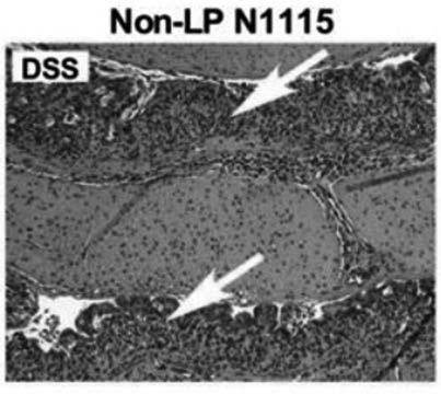 Application of lactobacillus paracasei N1115 in preventing colonitis, corresponding probiotic powder and application