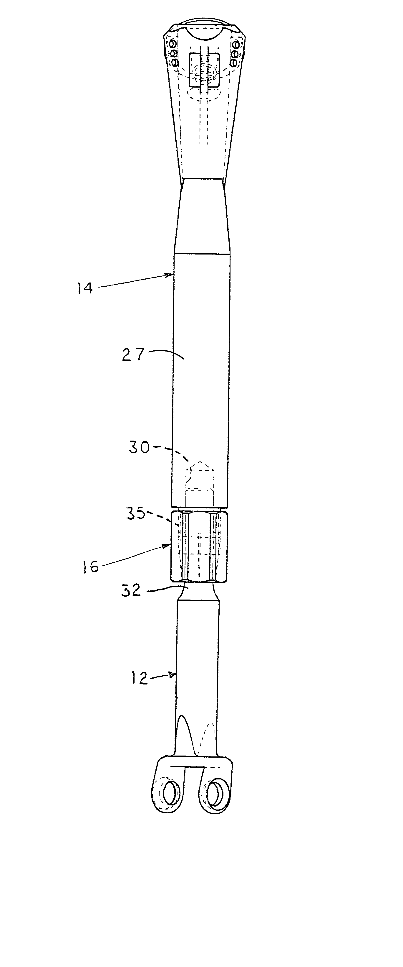 Adjustable long bone prosthesis