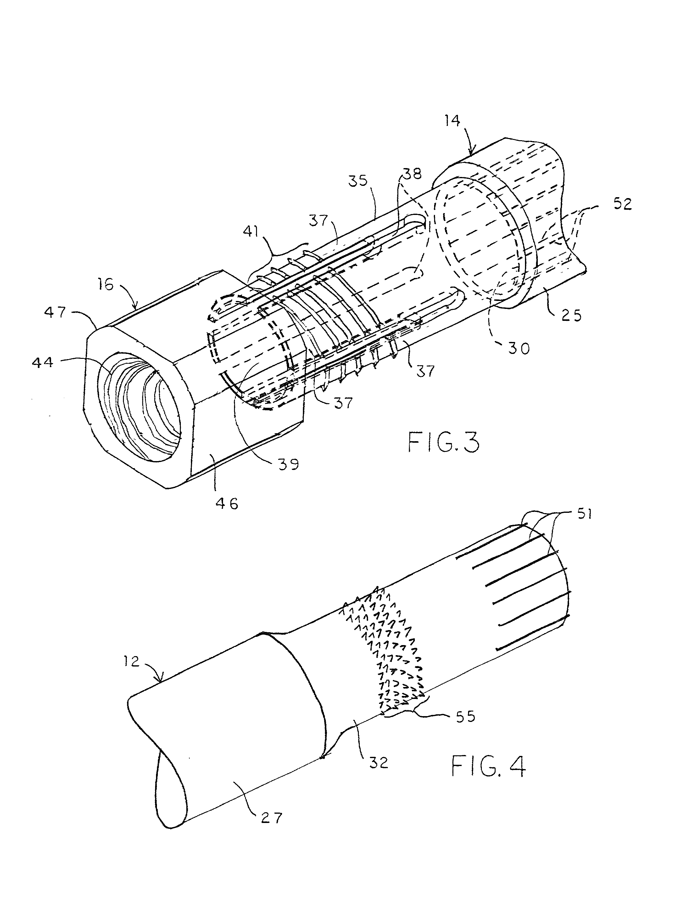 Adjustable long bone prosthesis