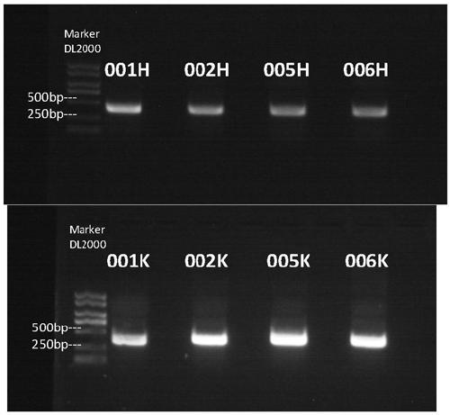 Antibody targeting AXL and antibody-drug conjugate and preparation method and application thereof