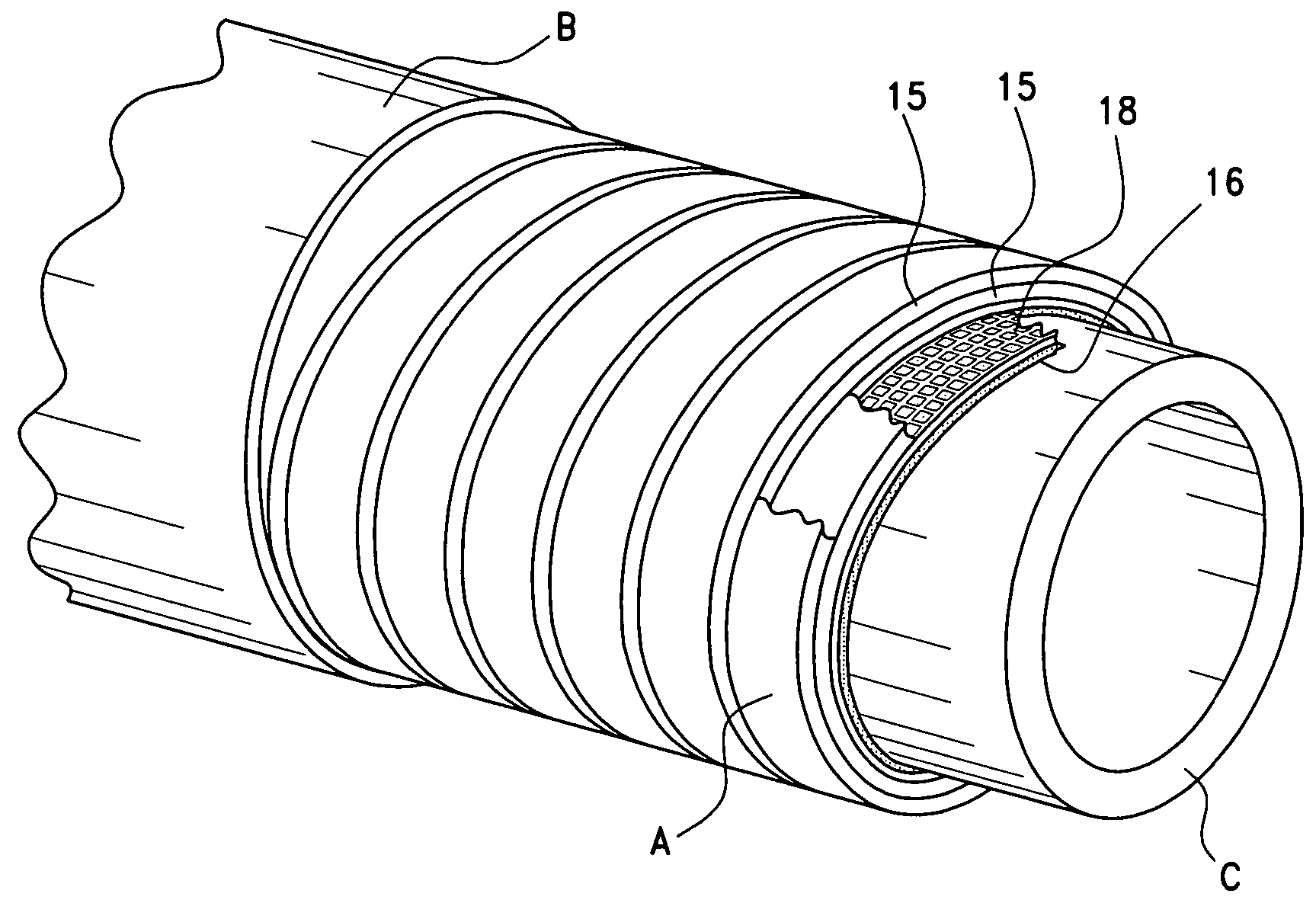 Anti-collapse system and method of manufacture