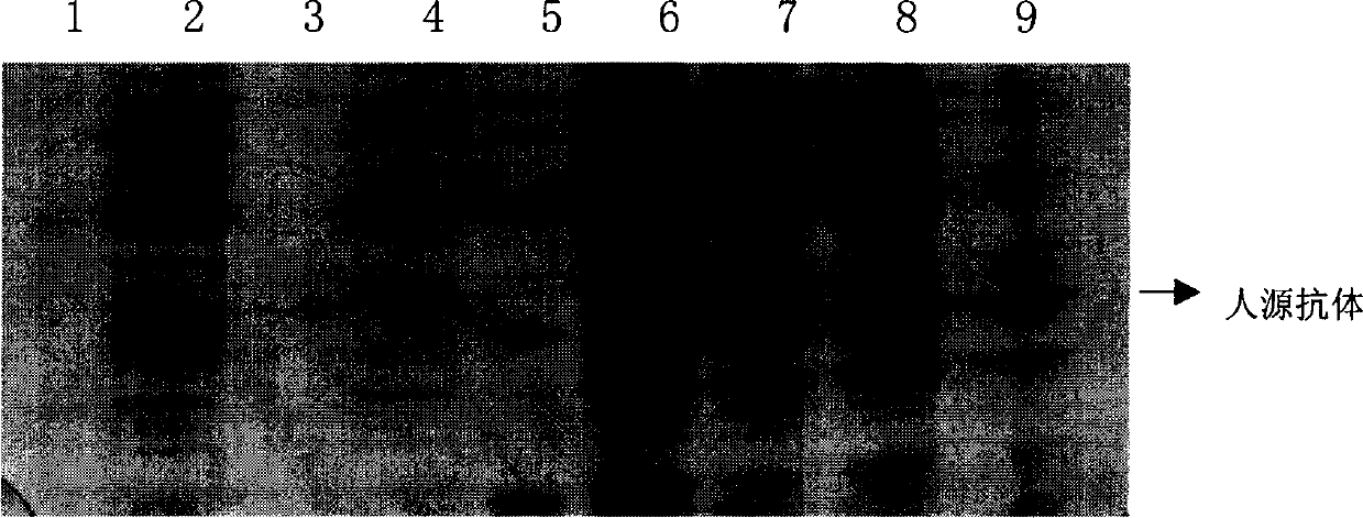 Preparation and use of testes specificity protein 50 human source antibody