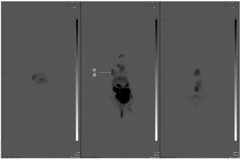 Al-18F mark fusion peptide and application thereof