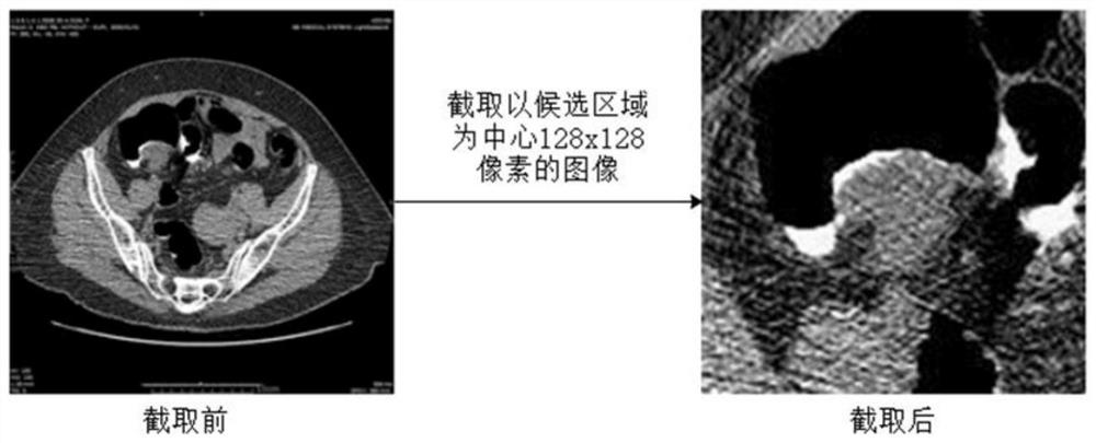 End-to-end colorectal polyp image segmentation method based on effective learning