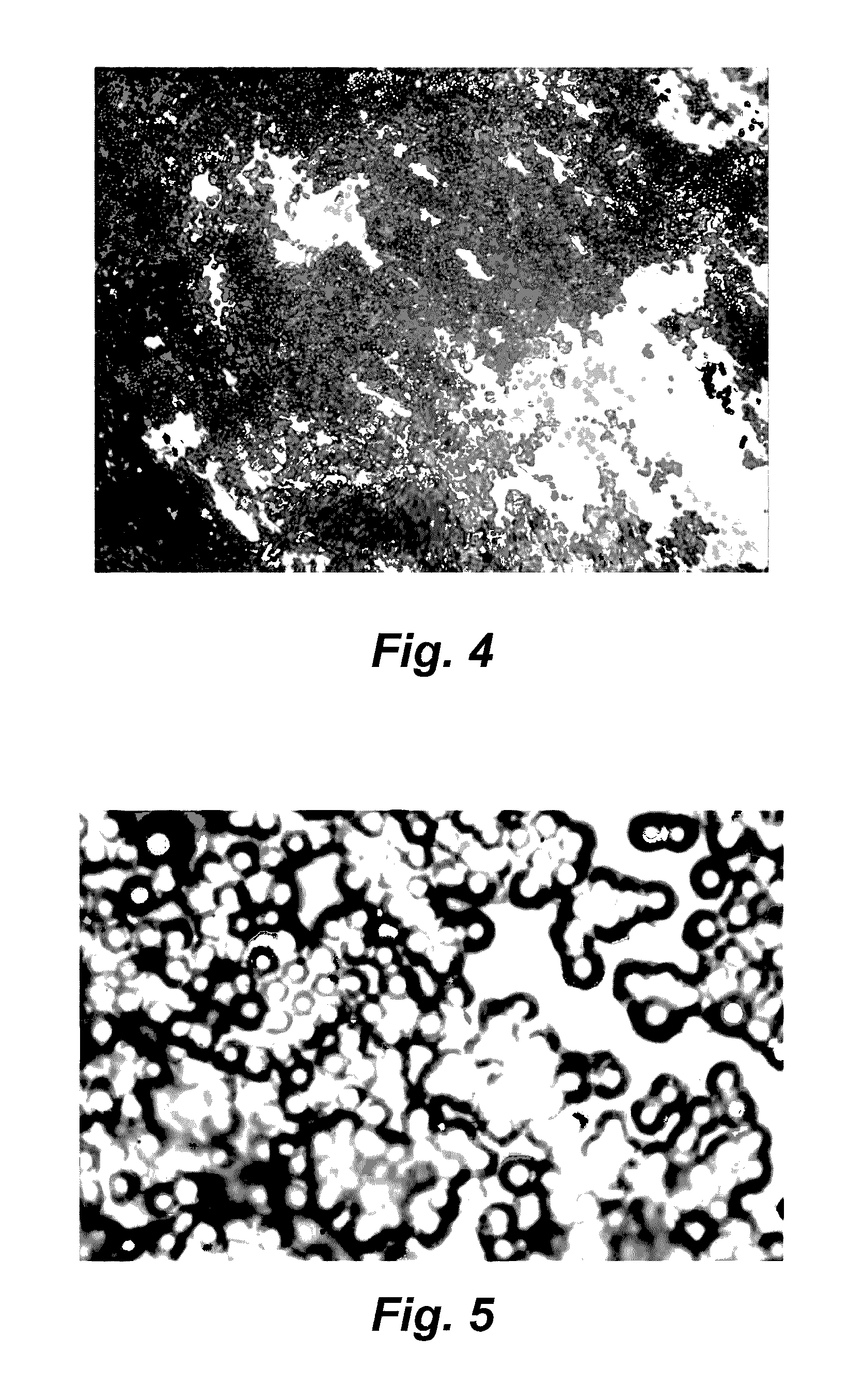 Coating for intraluminal expandable catheter providing contact transfer of drug micro-reservoirs