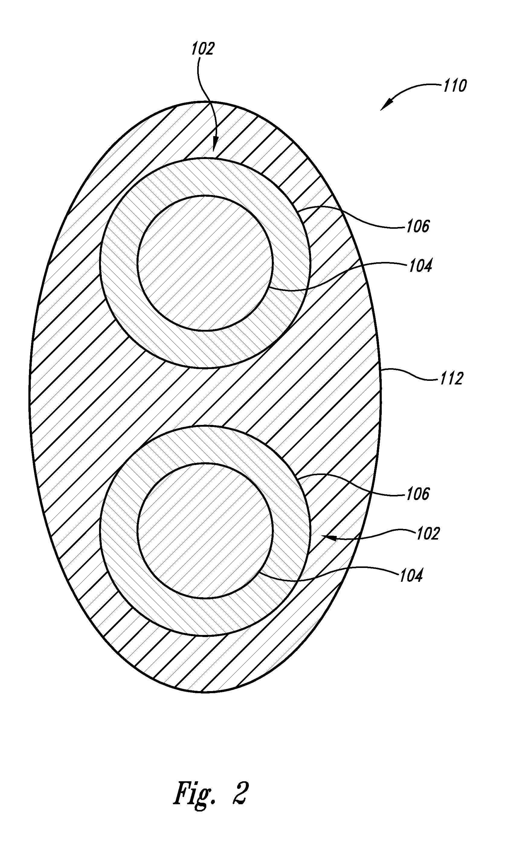 Enhanced implantable antenna system and method