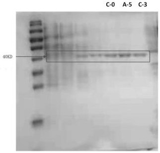 A kind of recombinant protein and its construction method and use