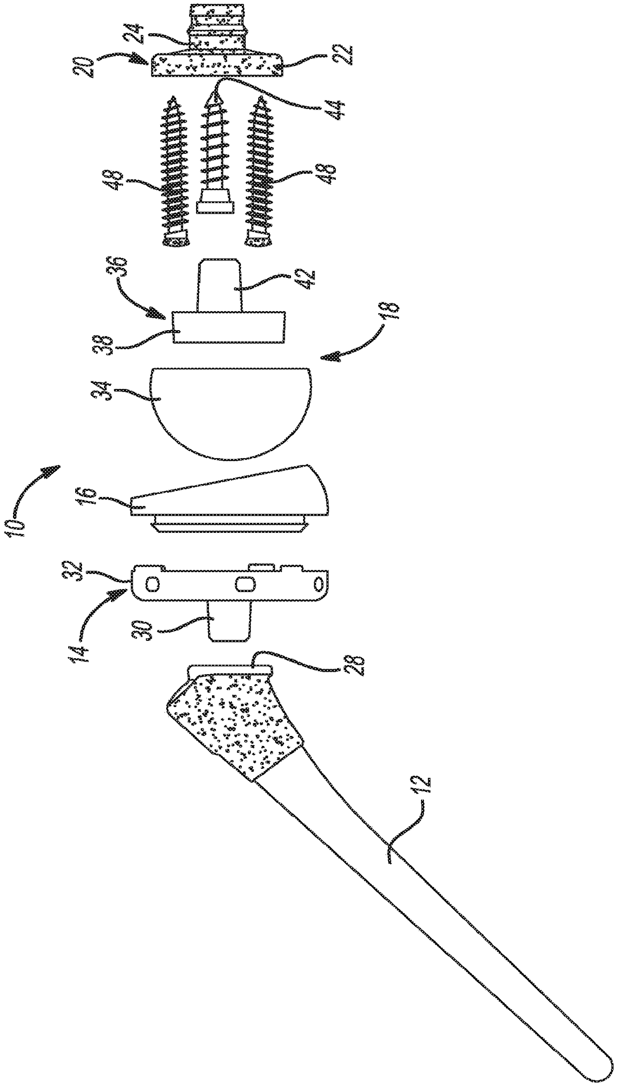 Patient-specific humeral guide designs