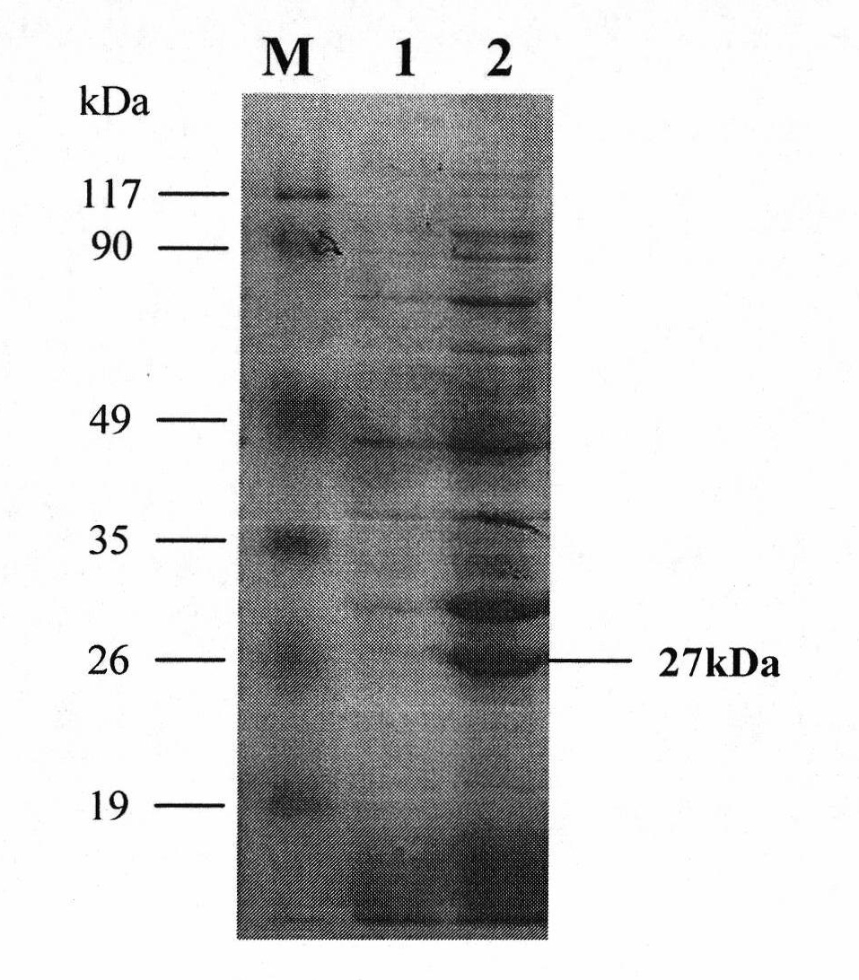 High-yield and temperature-resistant beta-dextranase pichia pastoris and construction thereof