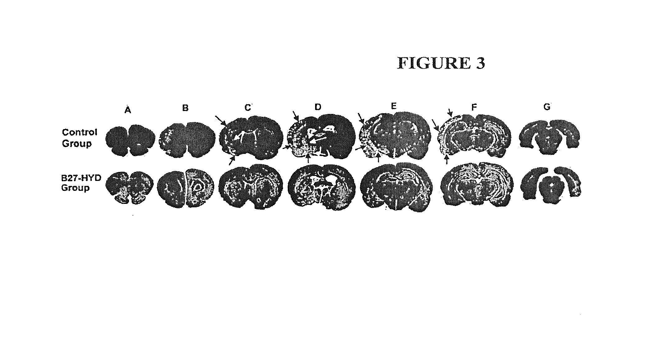 Methods, systems, and compositions for calpain inhibition