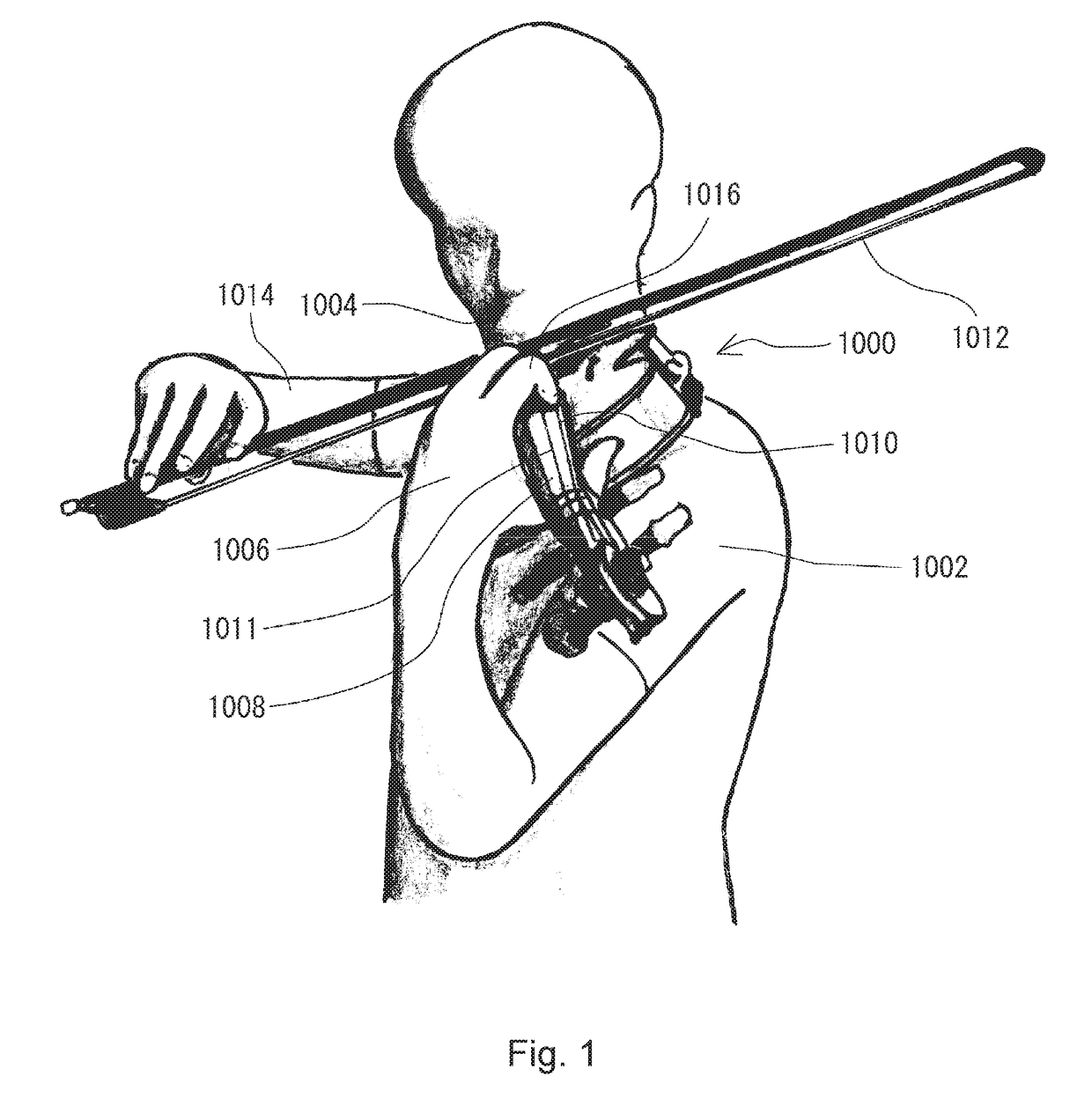 Bowed string instrument