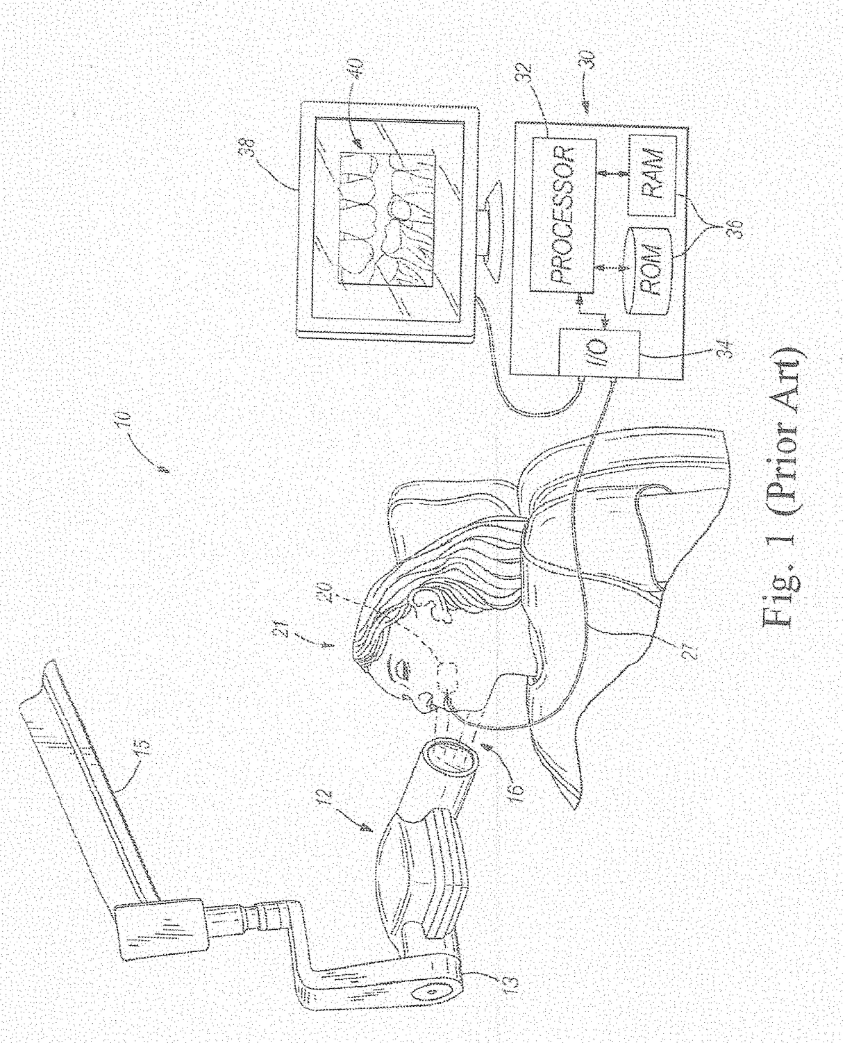 Intraoral Dental Radiological Imaging Sensor