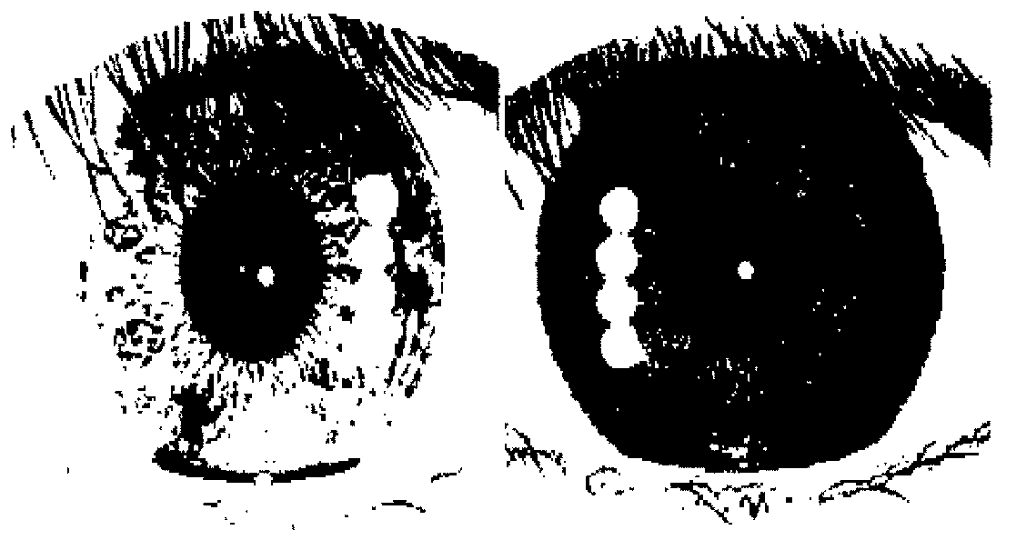 Apparatus and method for iris recognition using multiple iris templates