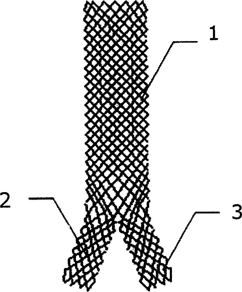 Y-shaped Ni-Tialloyed tracheal net braided support and its mfg. method