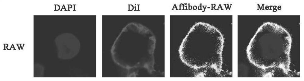 Targeted delivery system based on functionalized macrophages/monocytes, and construction and application of targeted delivery system