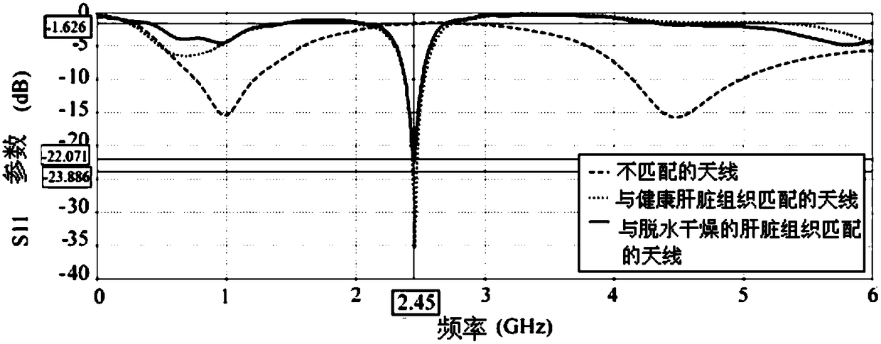 Microwave ablation antenna