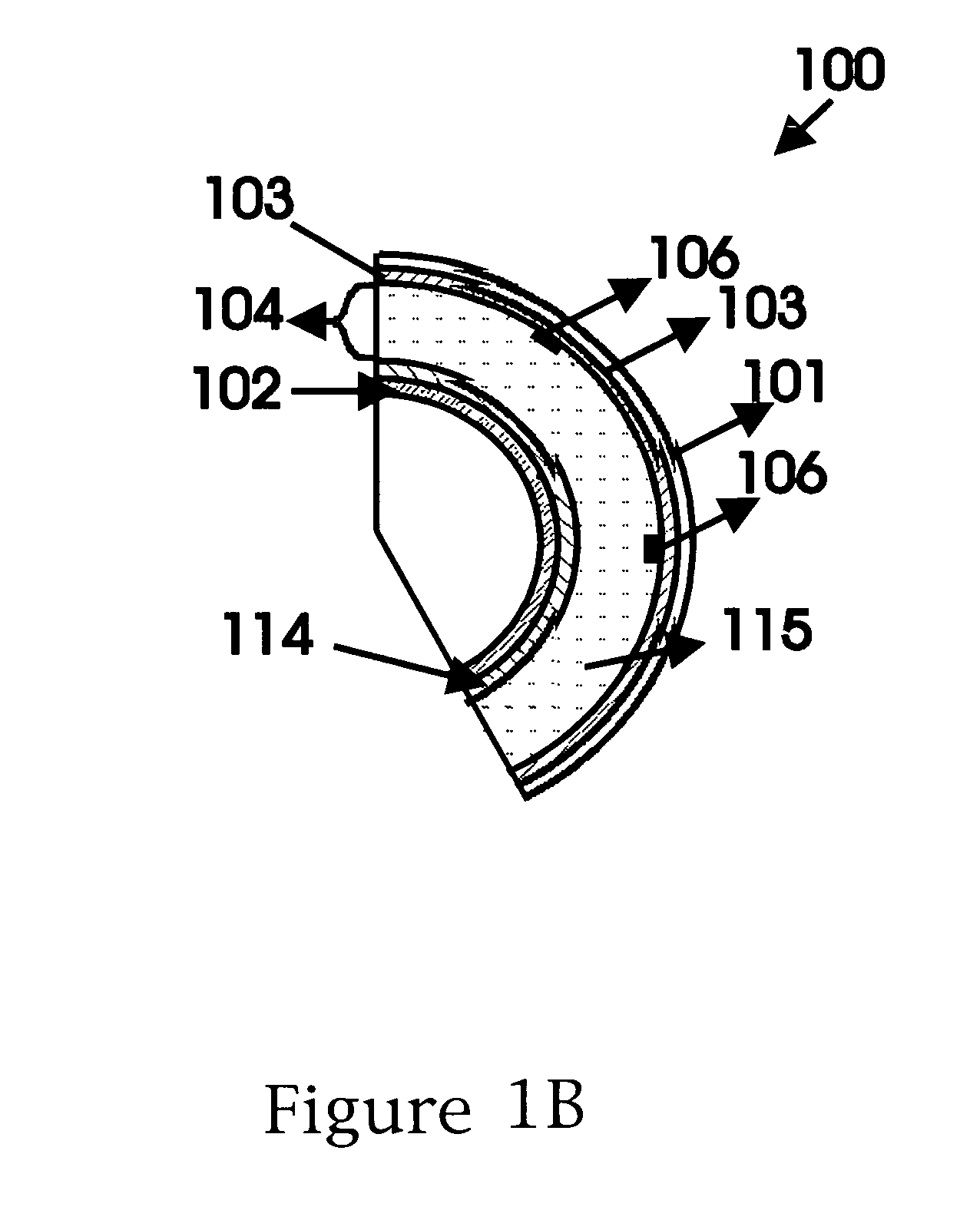 Scalable spherical laser