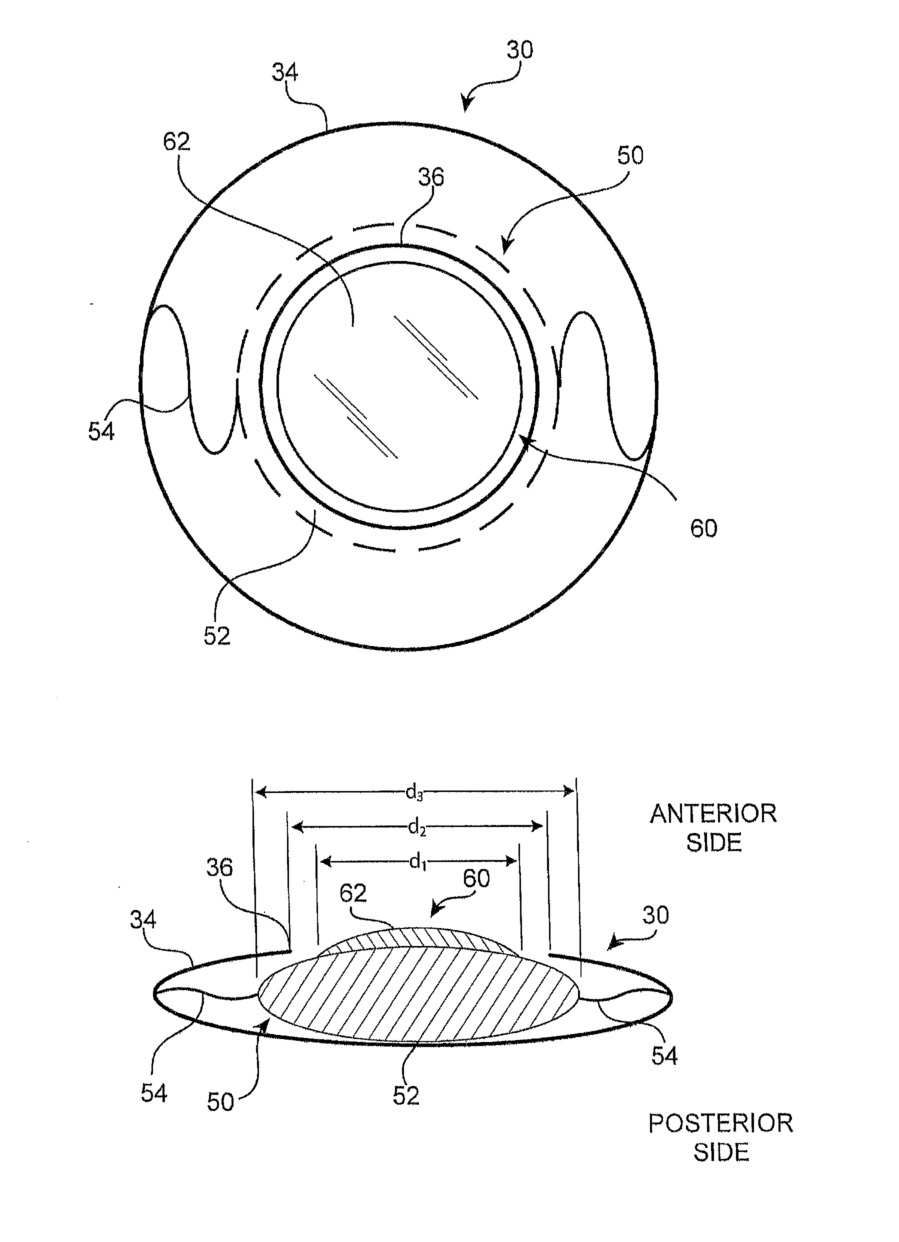 Modular intraocular lens designs and methods