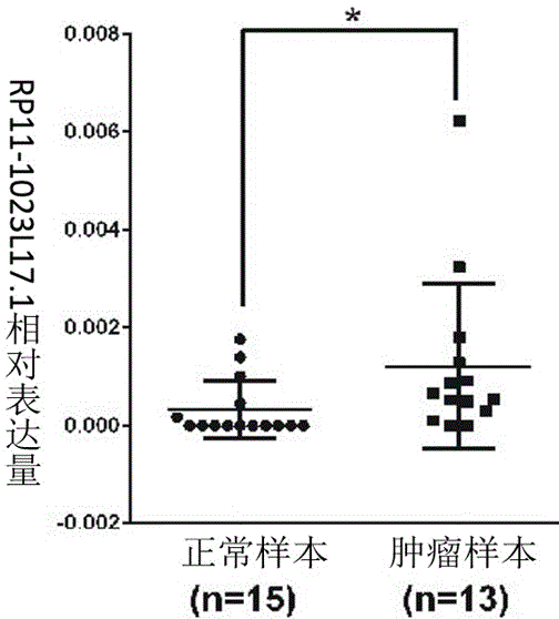 Prostatic cancer molecular target RP11-1023L17.1 and application thereof to diagnostic kit