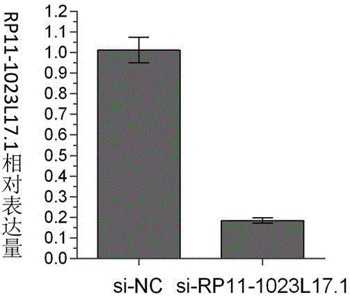 Prostatic cancer molecular target RP11-1023L17.1 and application thereof to diagnostic kit