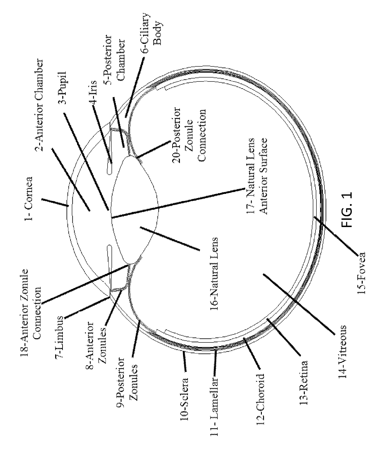 Accommodative intraocular lens that ejects post capsular opacification and self-centers