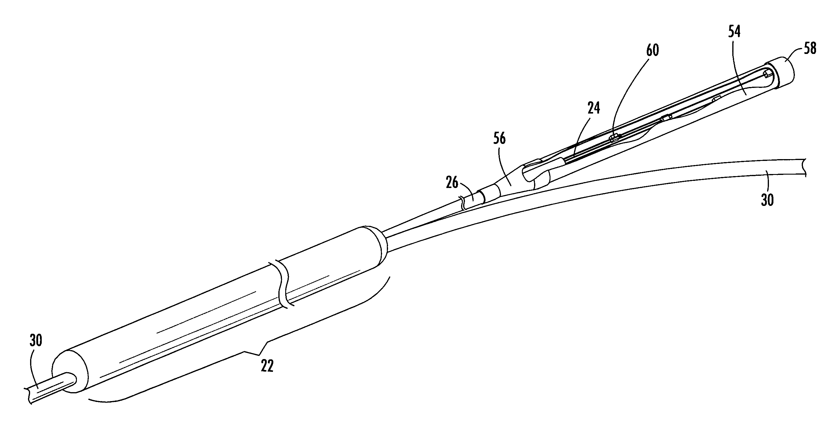 Distribution cable assembly having overmolded mid-span access location