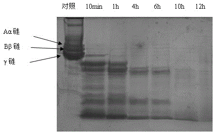 Actinomycete fibrinolytic enzyme and preparation method thereof