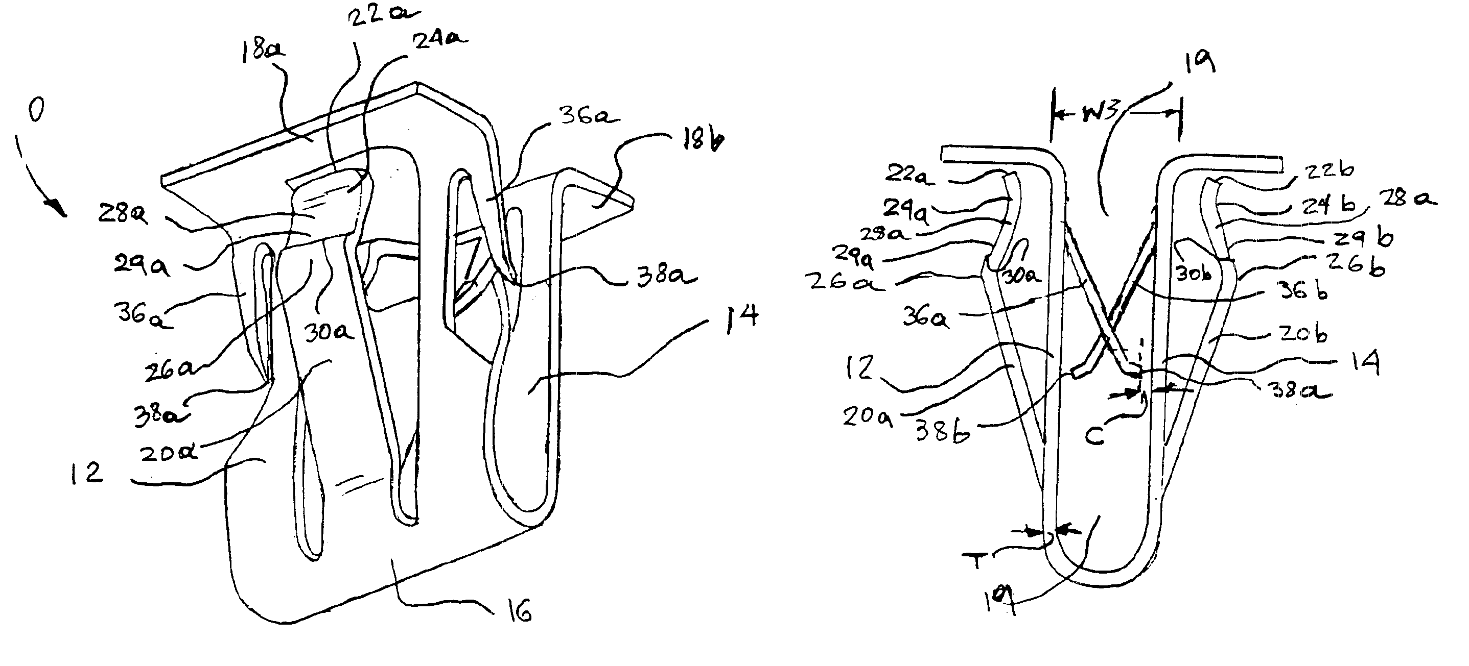 Assemblies comprising fastener with ergonomically balanced removal to insertion ratio