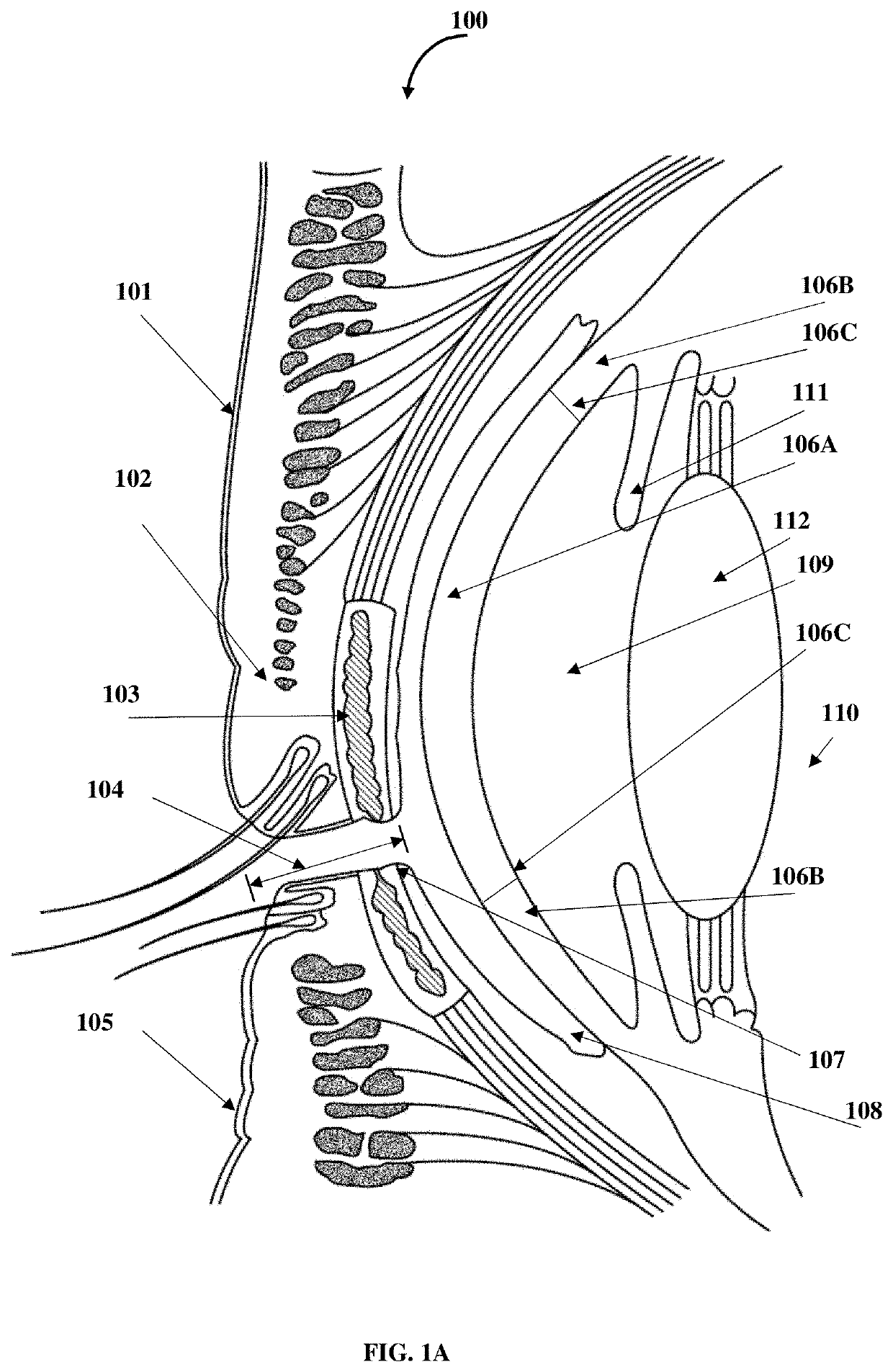 Compositions and methods for the treatment of anterior blepharitis and posterior blepharitis