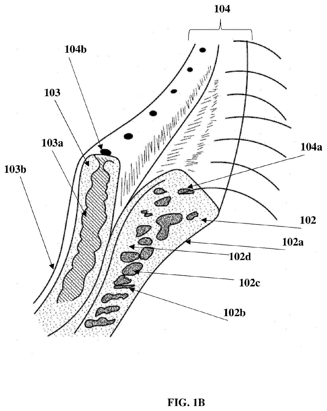 Compositions and methods for the treatment of anterior blepharitis and posterior blepharitis