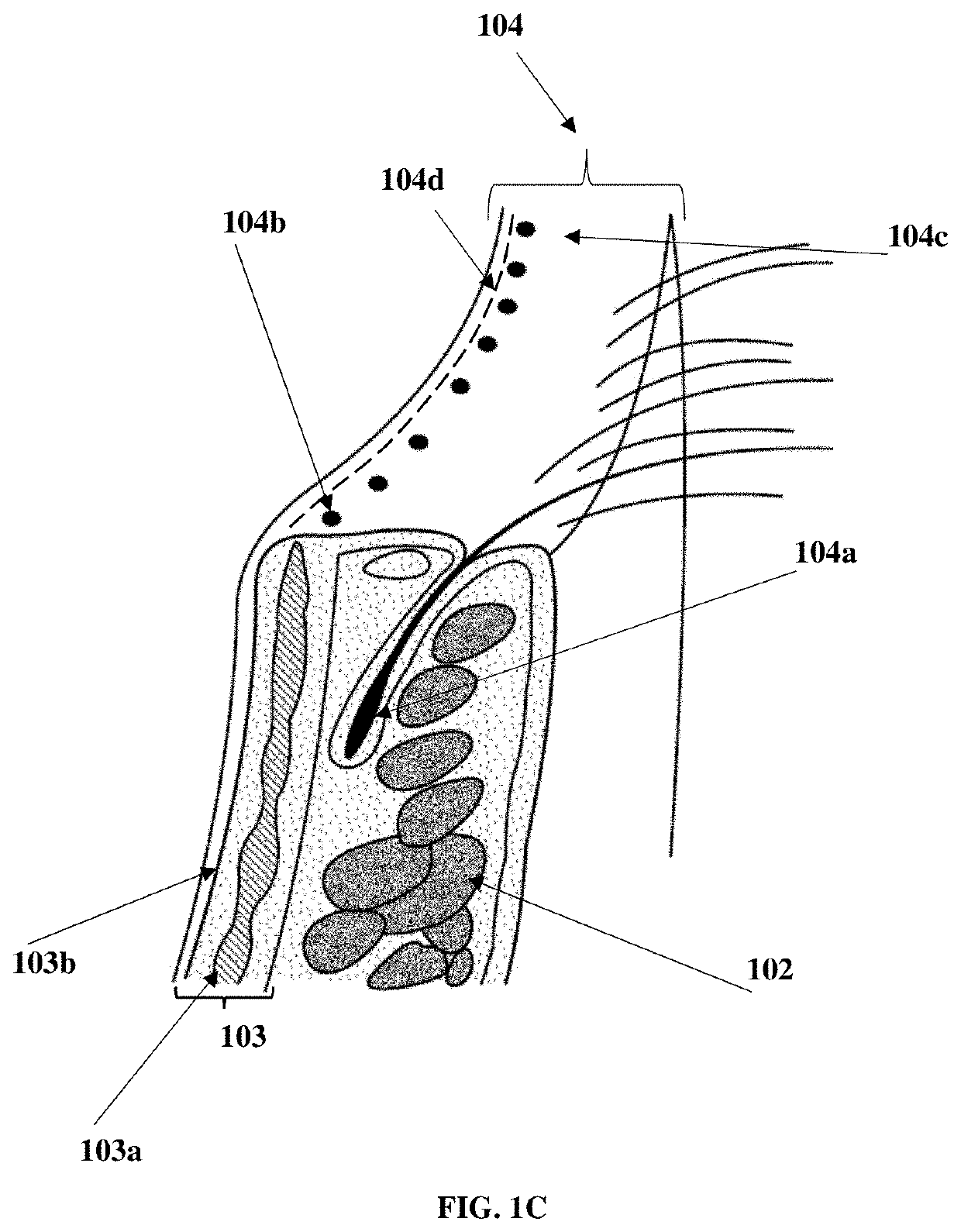 Compositions and methods for the treatment of anterior blepharitis and posterior blepharitis