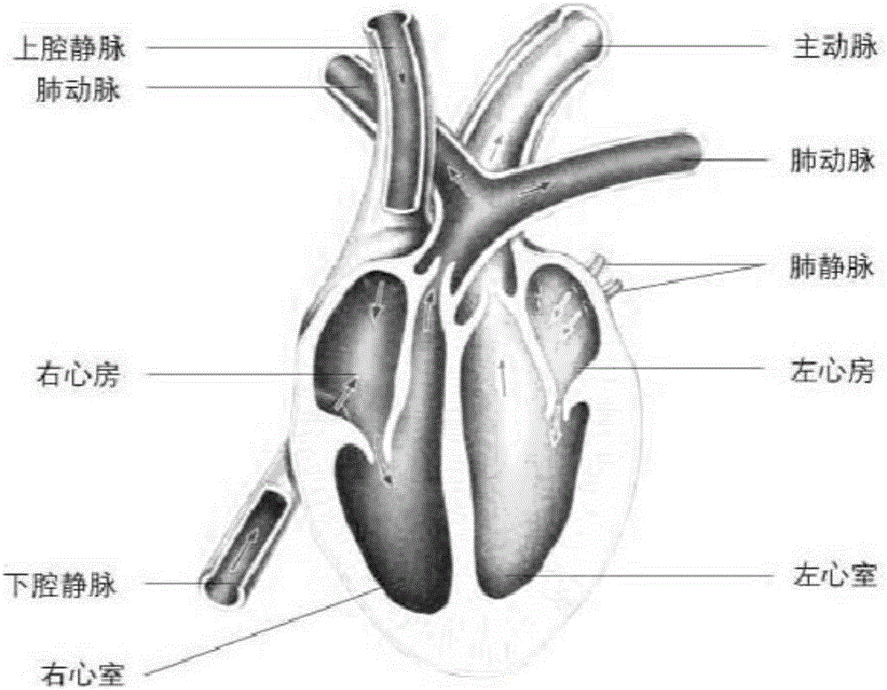 Device and method for achieving preoperative assessment of congenital heart disease operation plan based on 3D printing