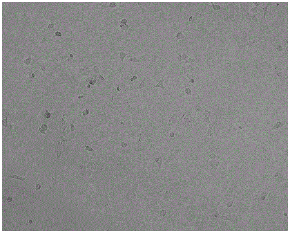 Method for performing modification of chitosan or derivative thereof on surface of medical polyurethane material