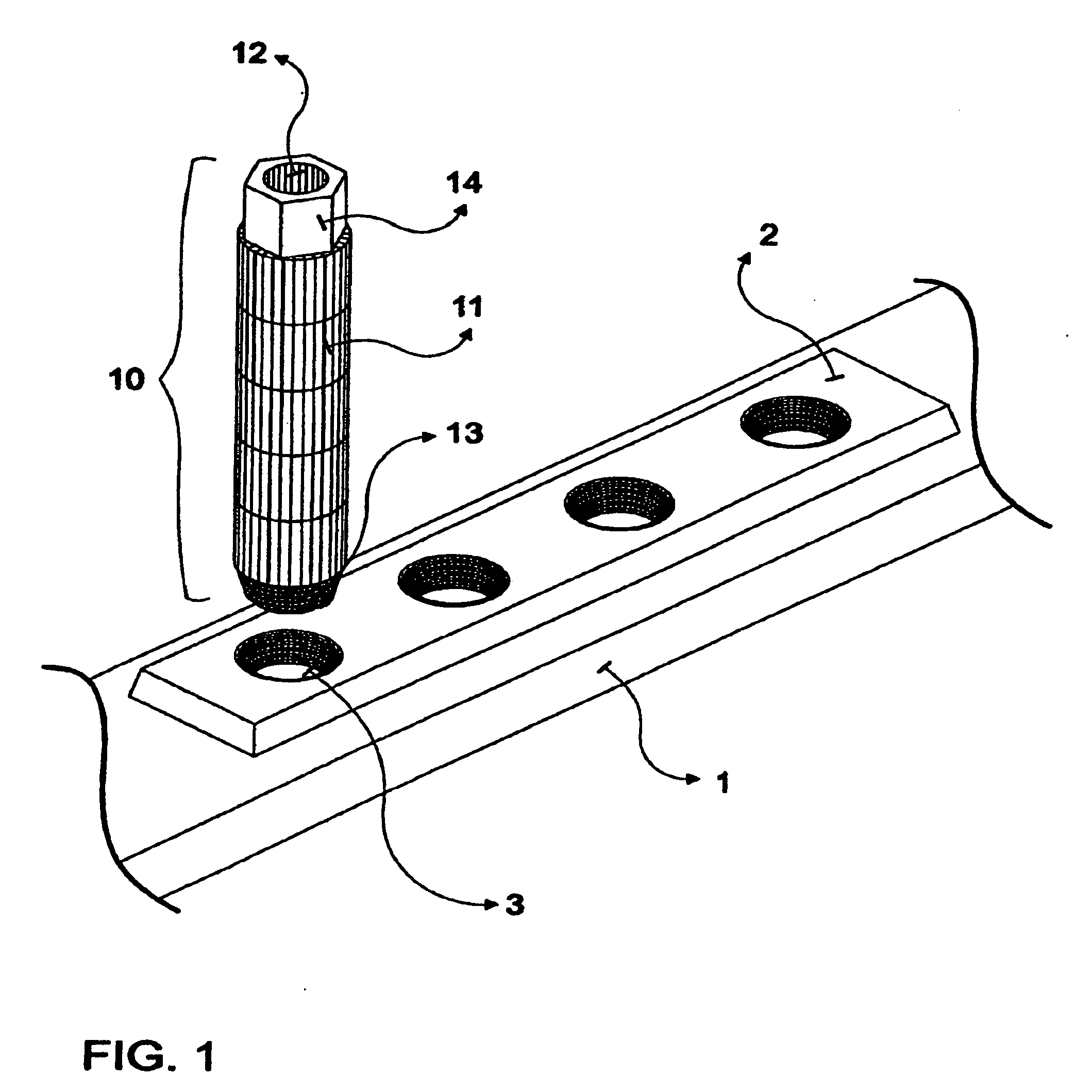 Locking Bone Plates with Controlled Locking Screw Misalignment