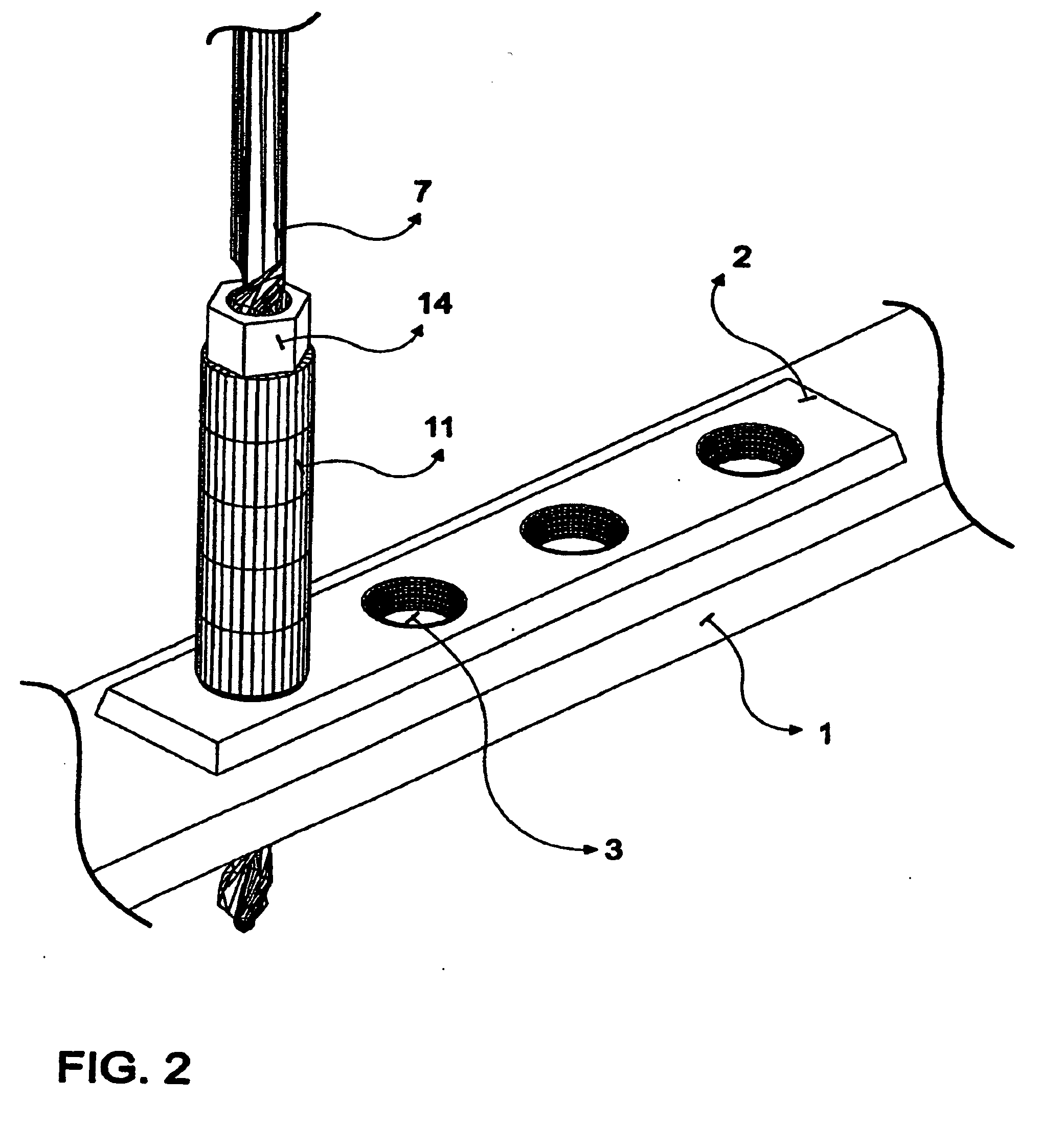 Locking Bone Plates with Controlled Locking Screw Misalignment