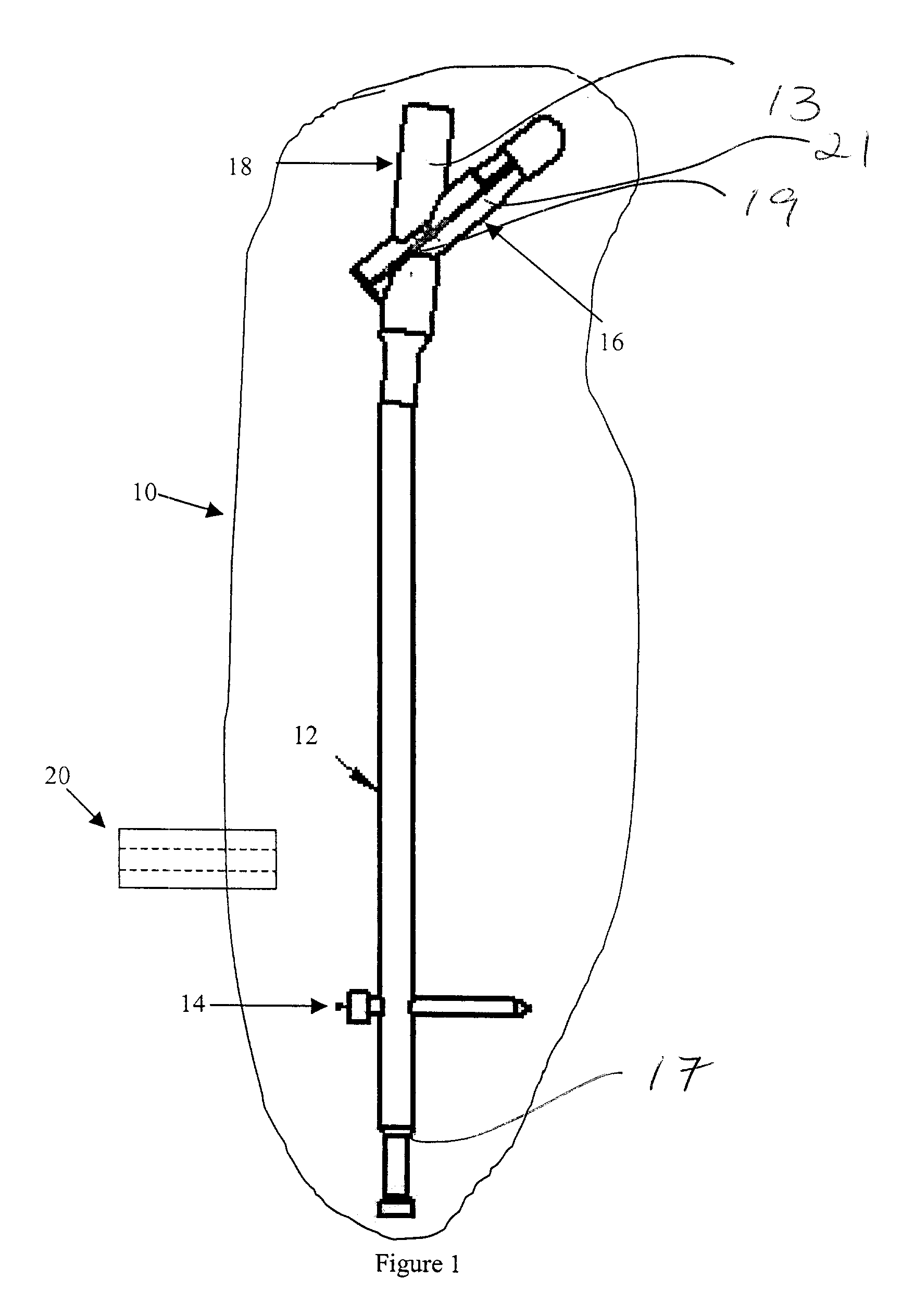 Intramedullary rod with vent