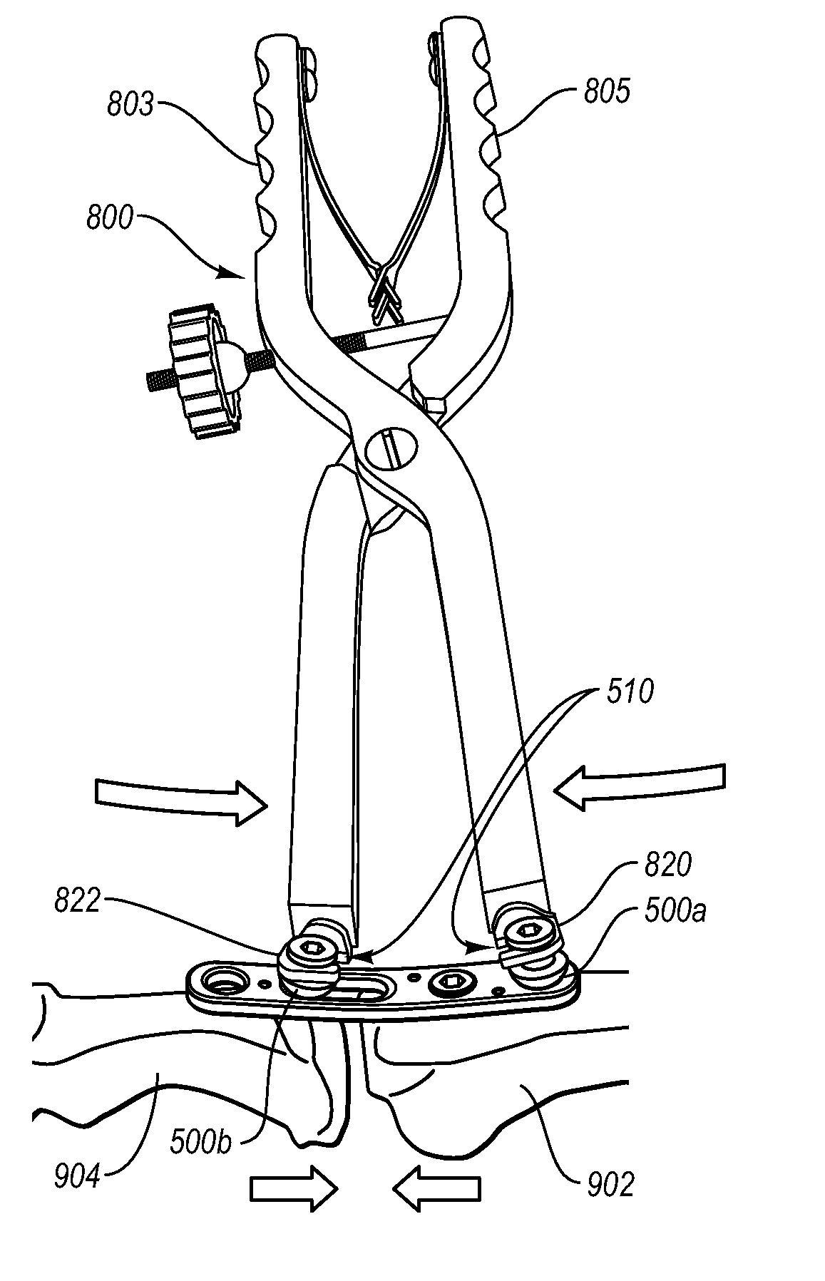 Methods for repairing bone discontinuities