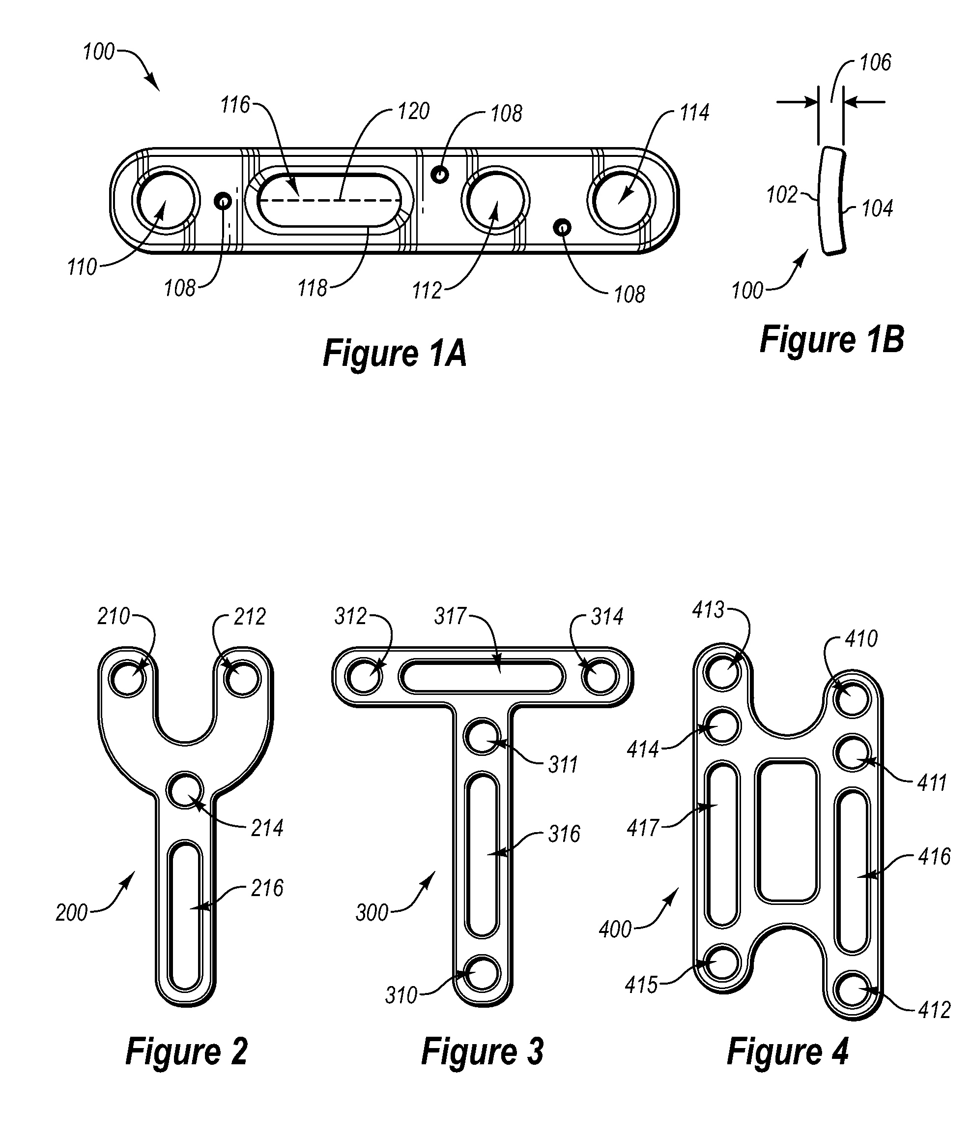 Methods for repairing bone discontinuities