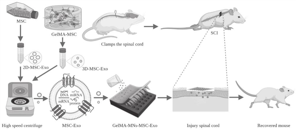 Exosome-loaded GelMA hydrogel microneedle as well as preparation method and application thereof