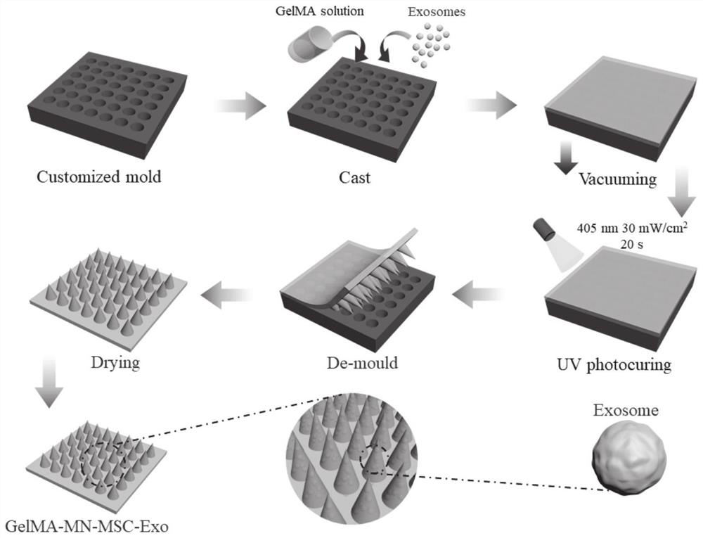 Exosome-loaded GelMA hydrogel microneedle as well as preparation method and application thereof