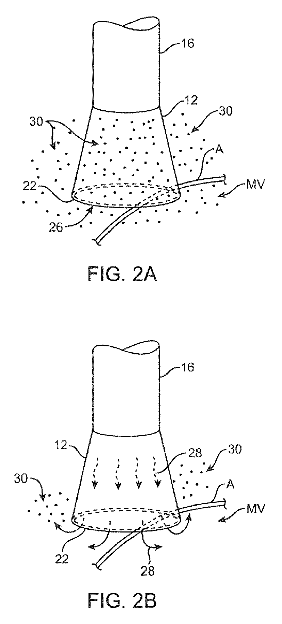 Catheter control systems