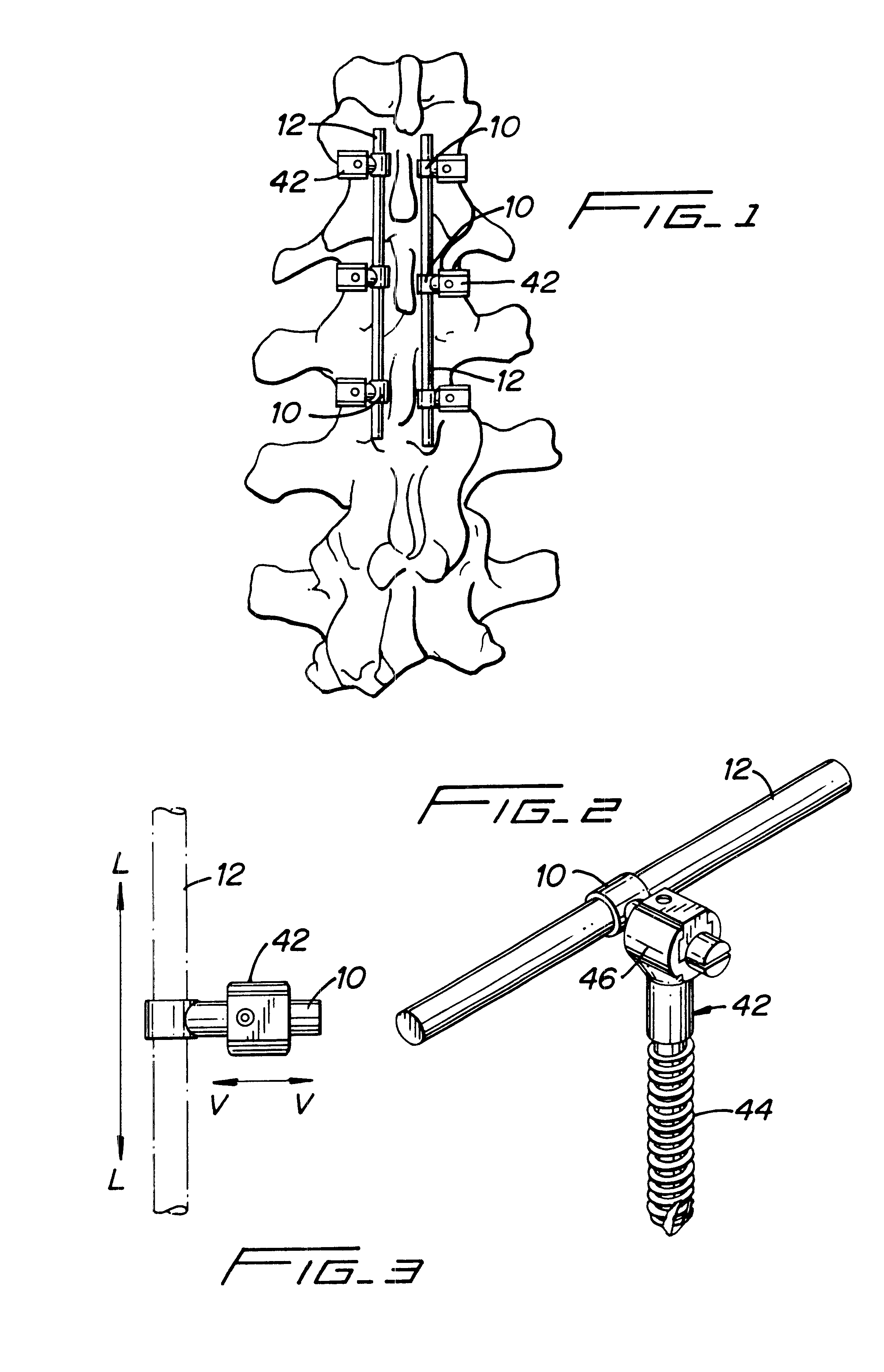 Clamping connector for spinal fixation systems