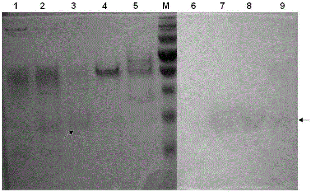 Polypeptide having pNPPC hydrolase activity and coding gene, preparation method and application thereof